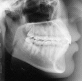 Radiologia Odontológica em Juazeiro